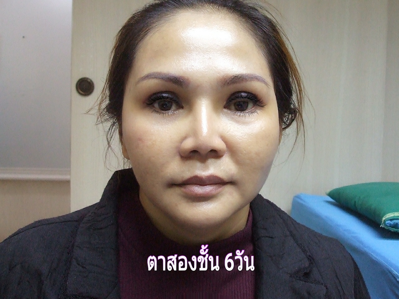 ตาสองชั้น