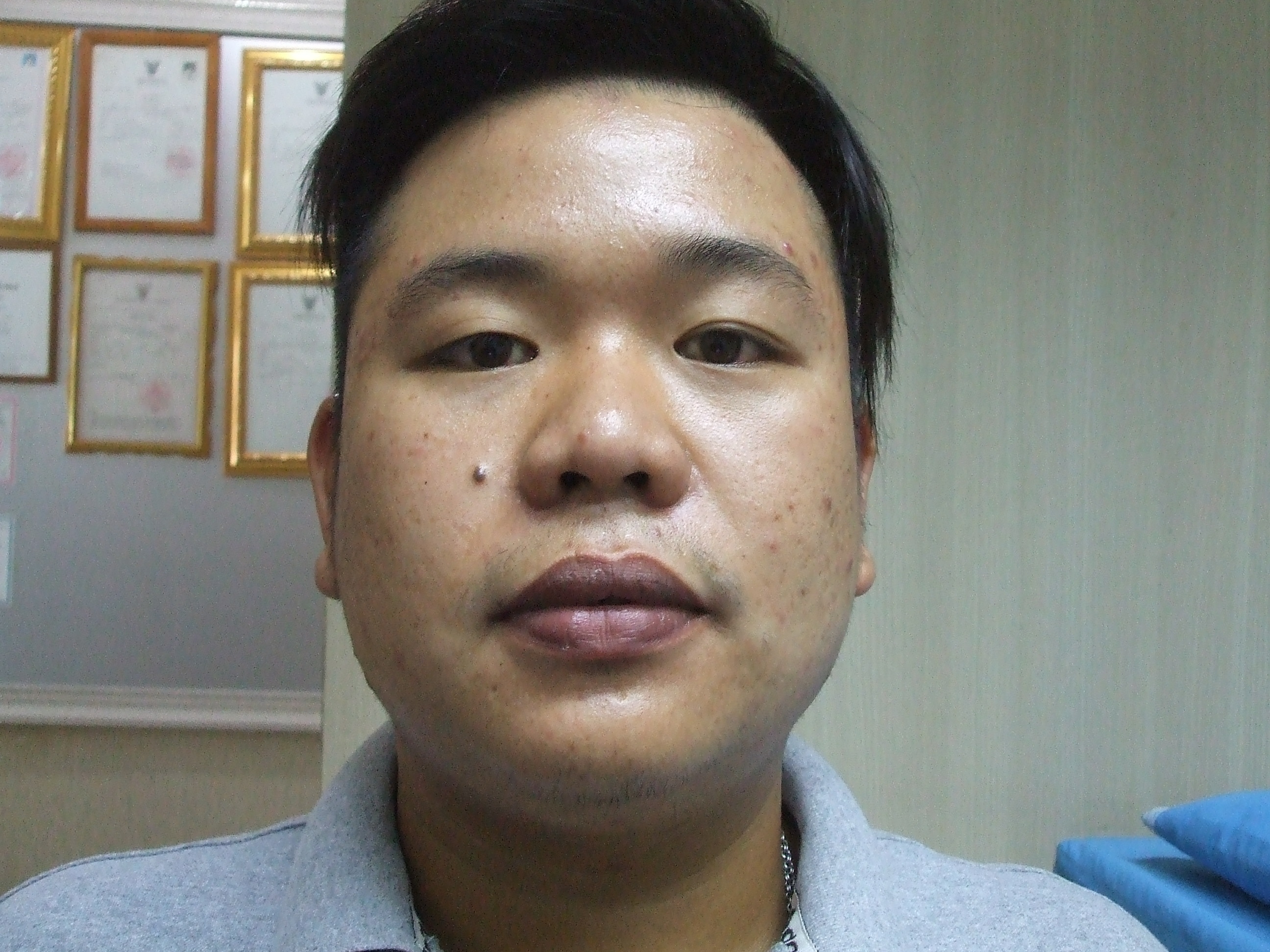 ก่อนทำตา
