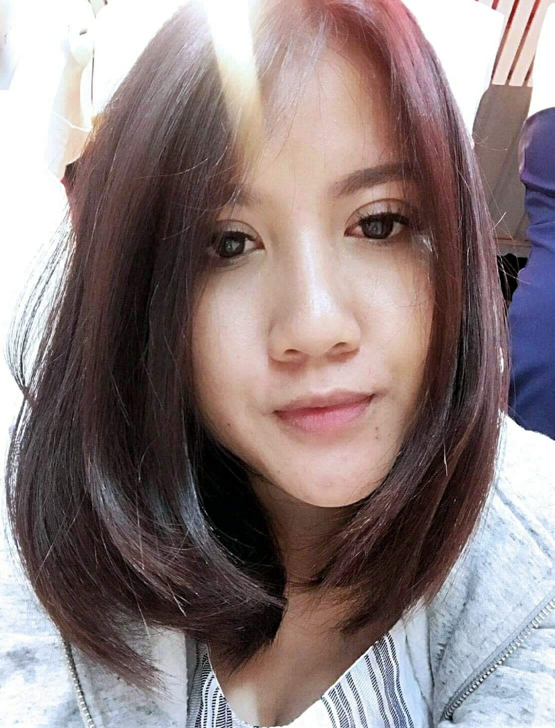 เสริมจมูก
