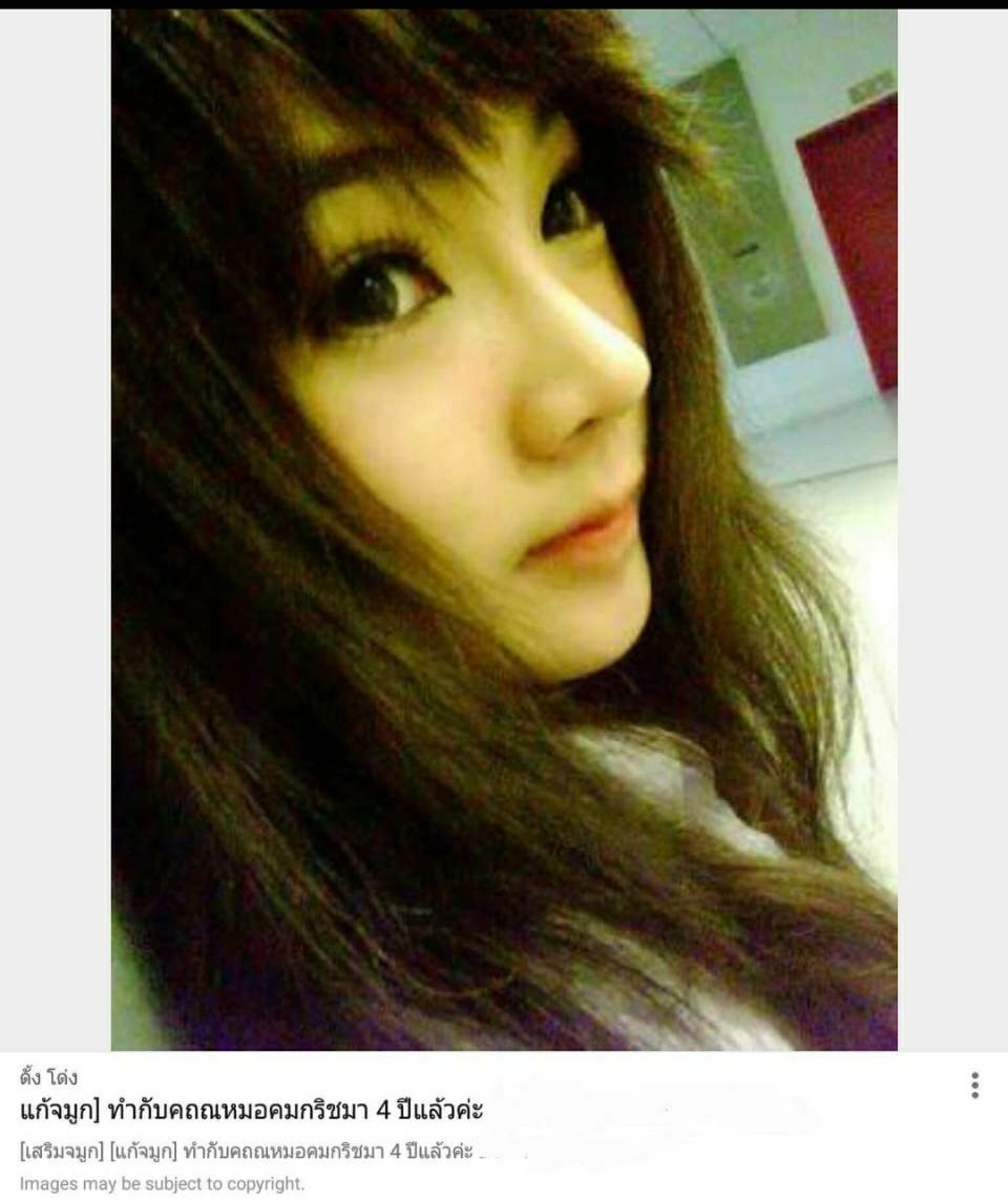 เสริมจมูก