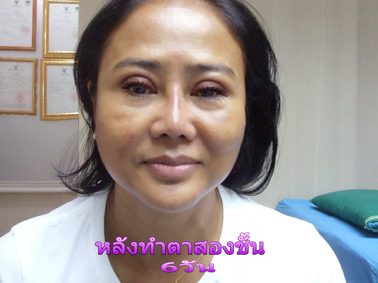 ตาสองชั้น