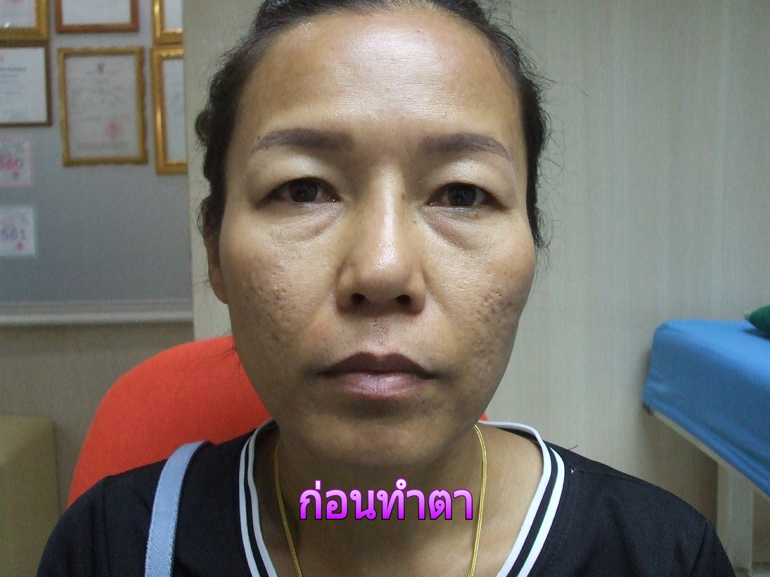 ตาสองชั้น