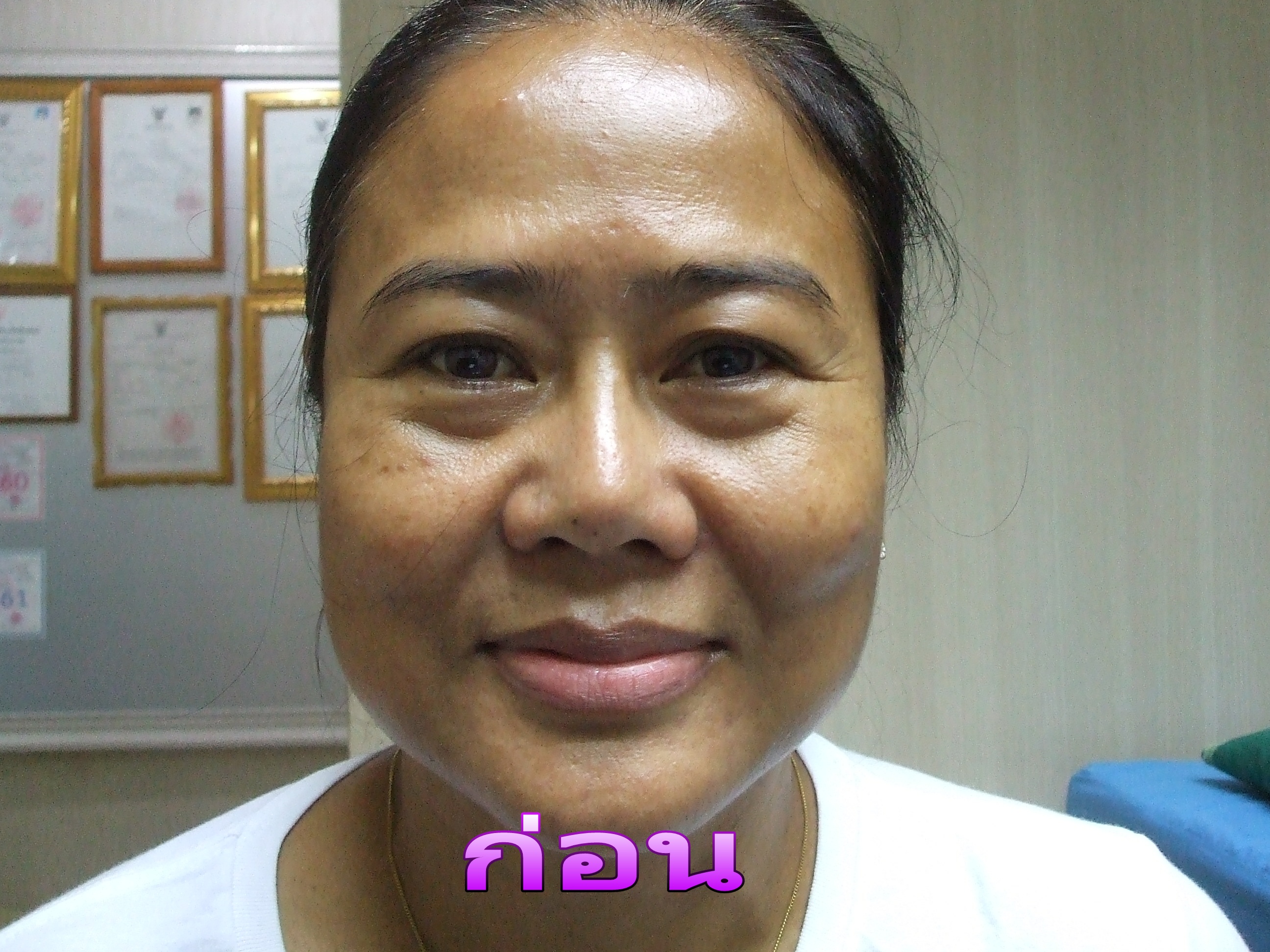 ตาสองชั้น