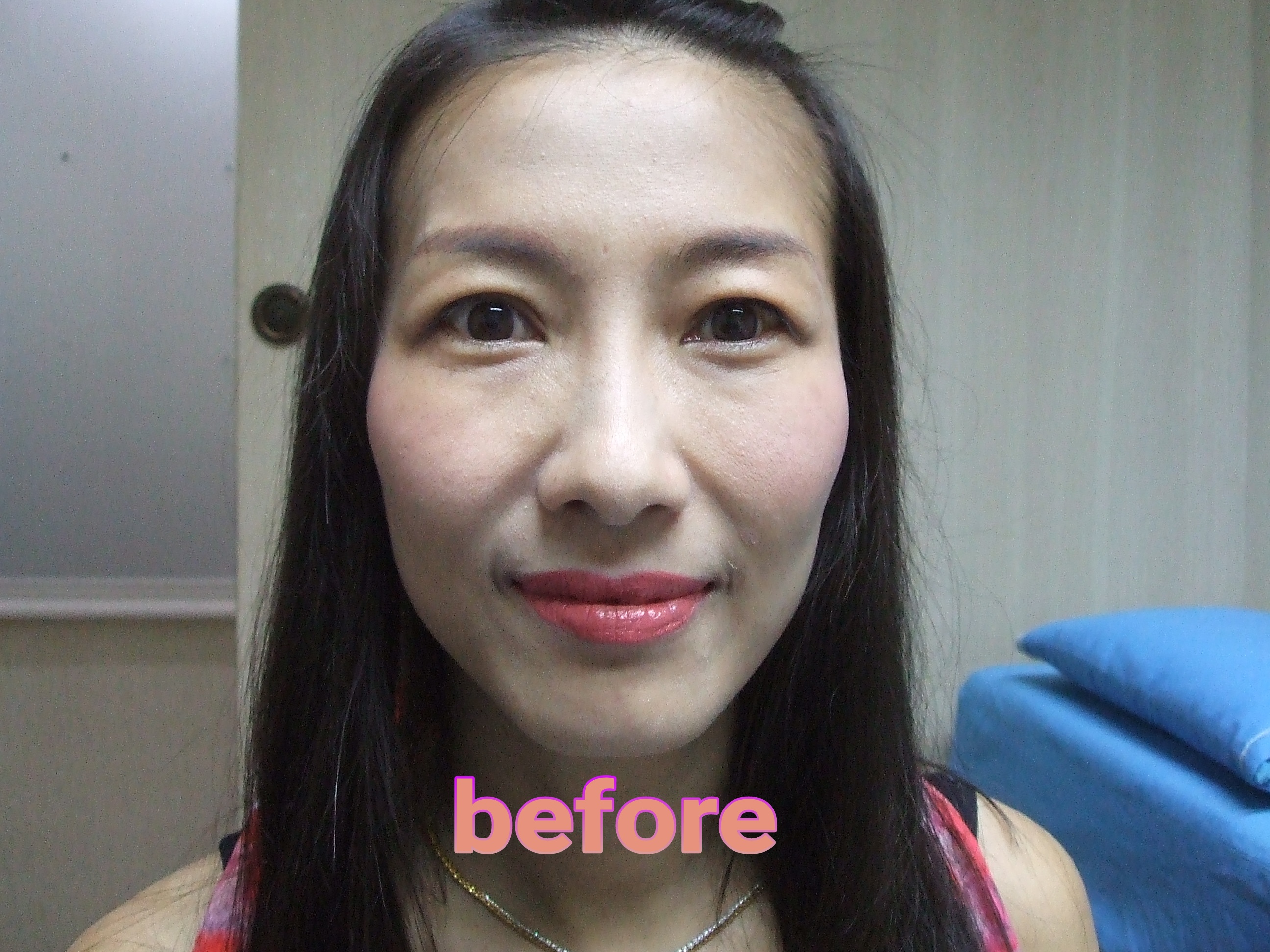 Beforeตาสองชั้น