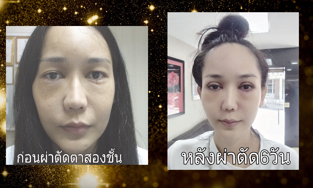 ตาสองชั้น