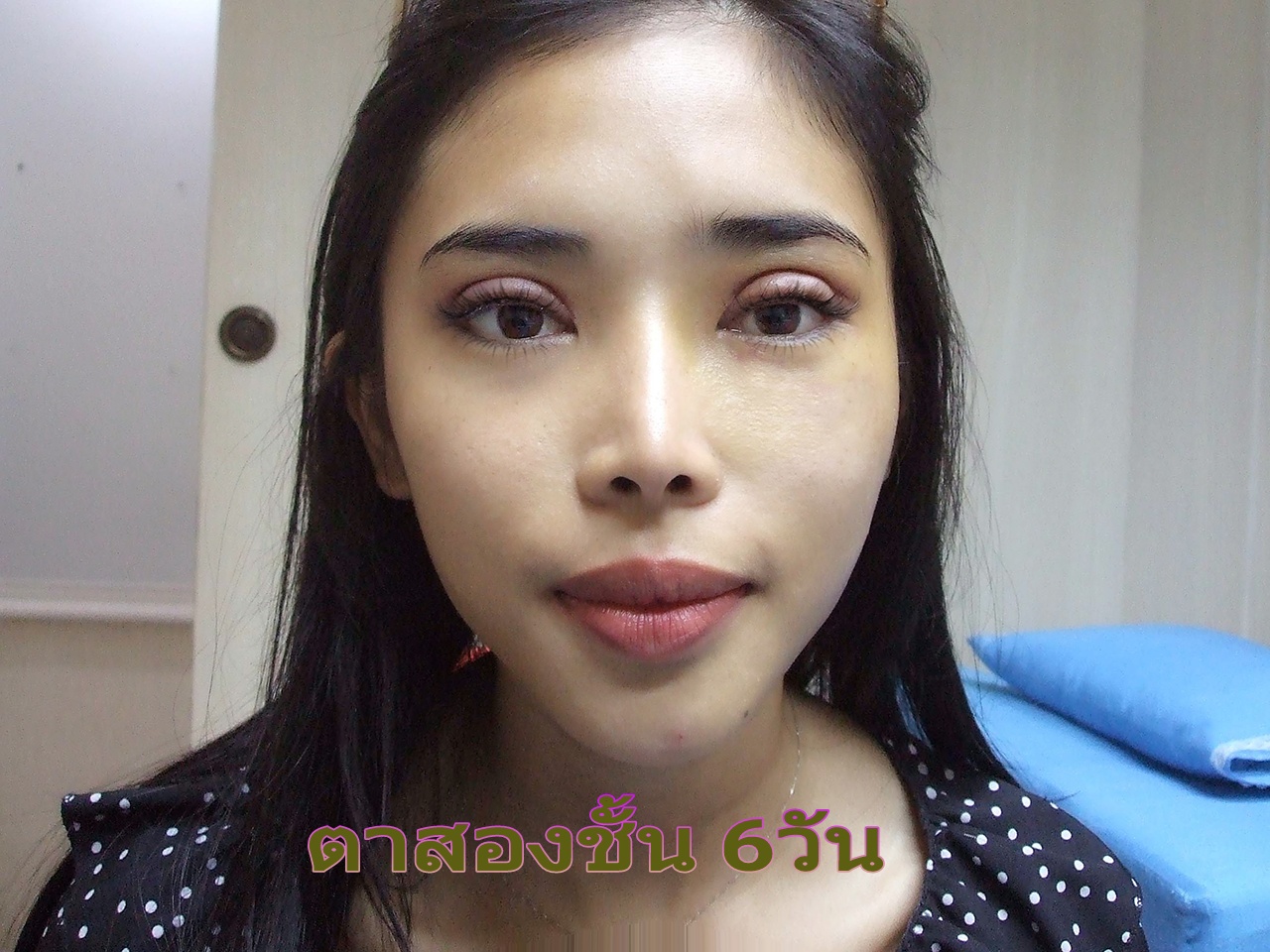 ตาสองชั้น