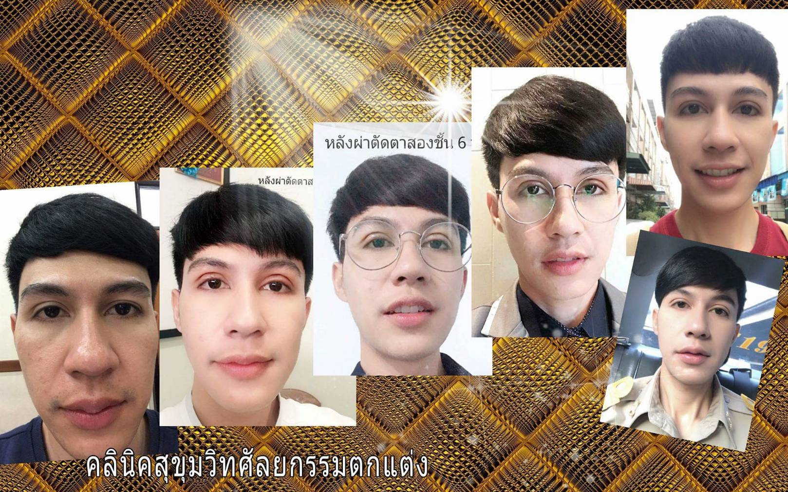 ตาสองชั้น