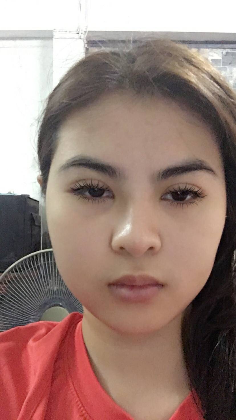 ทำตาสองชั้น เสริมจมูก
