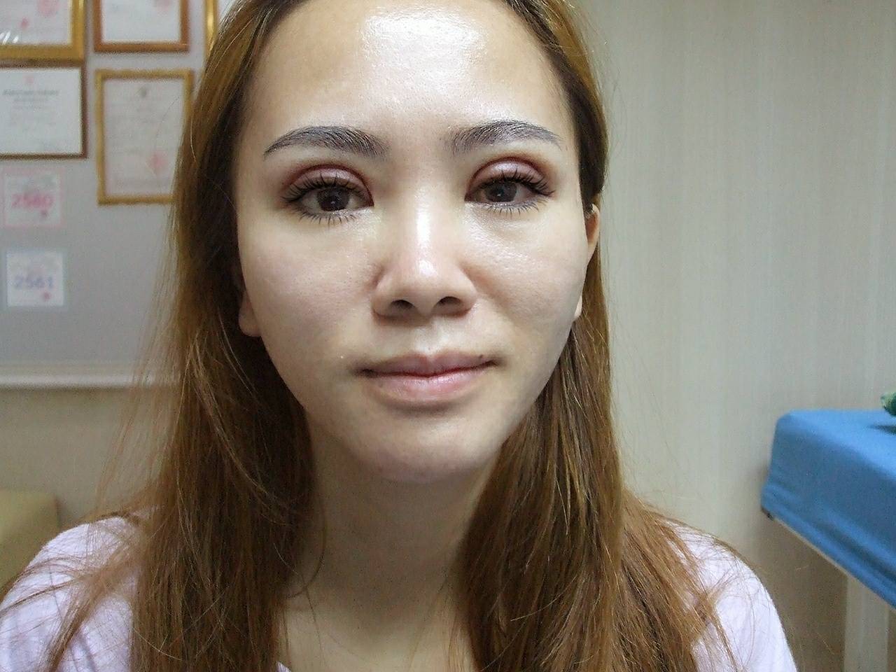 ทำตาสองชั้นหลัง