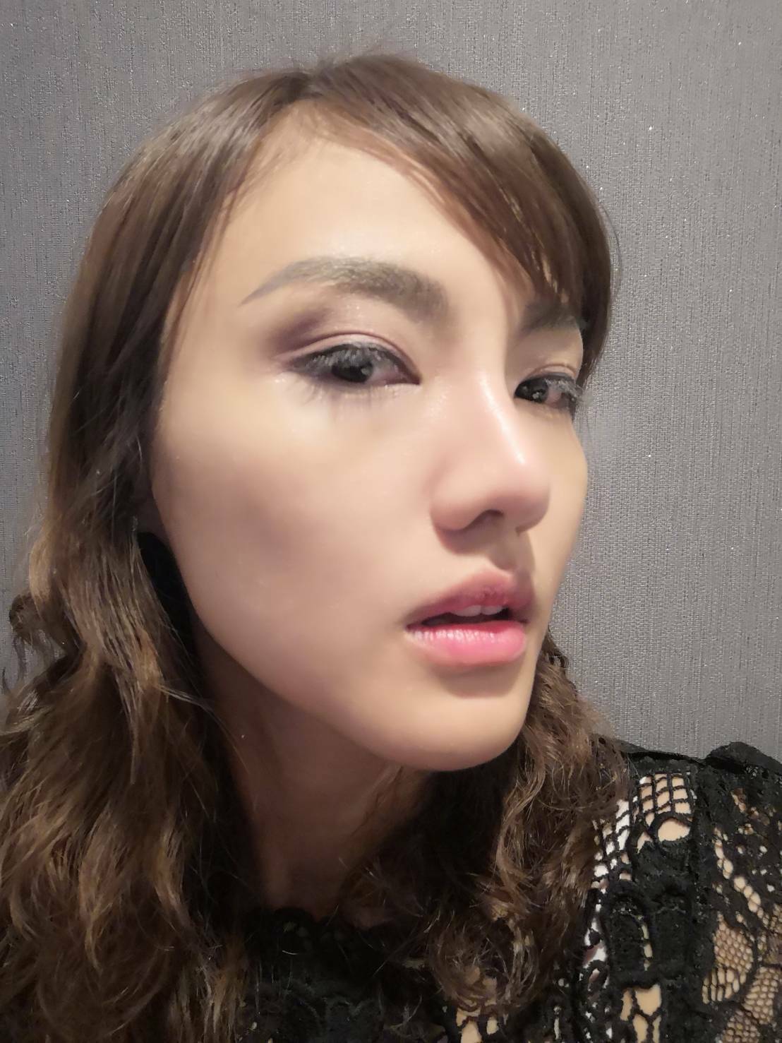 เสริมจมูก
