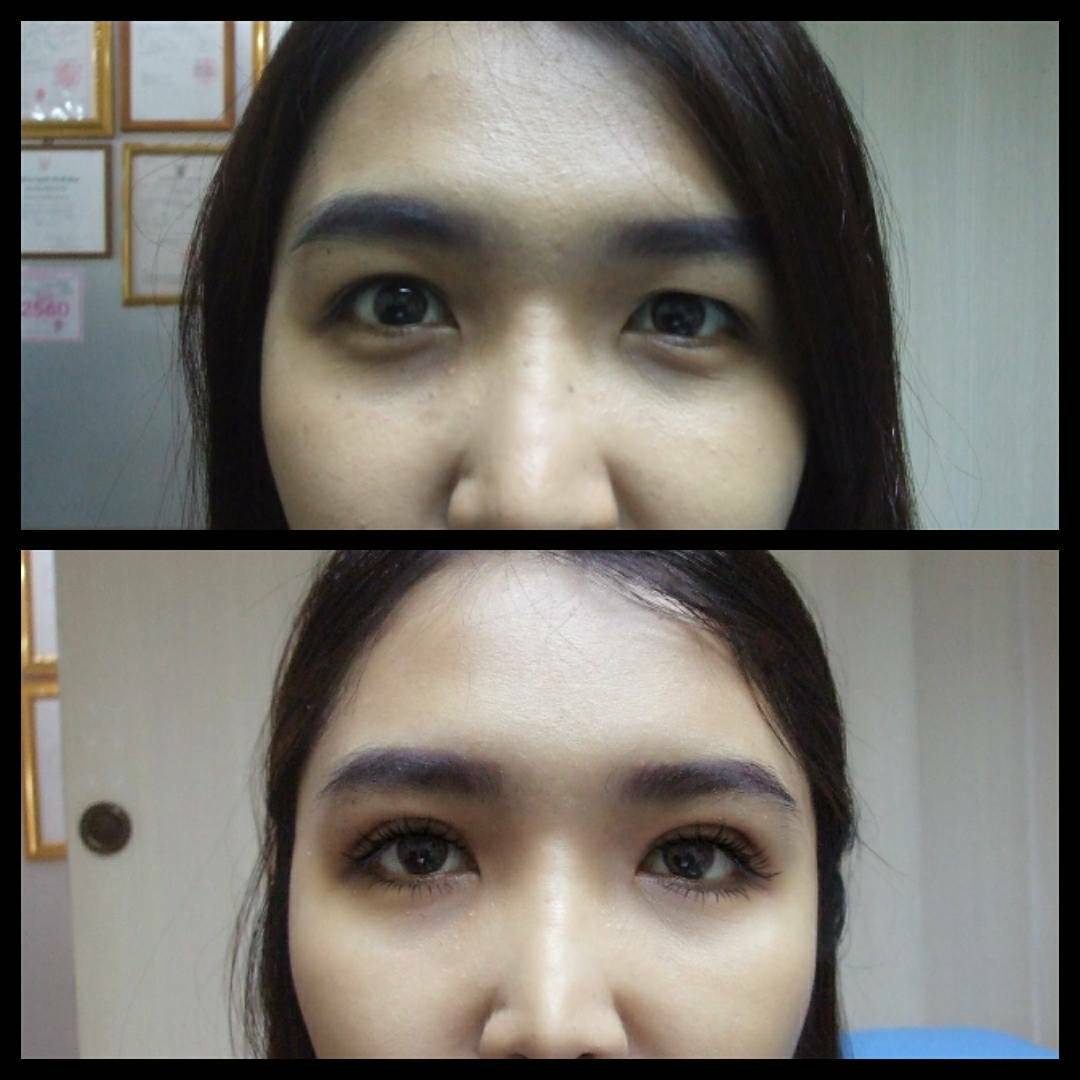 ตาสองชั้น