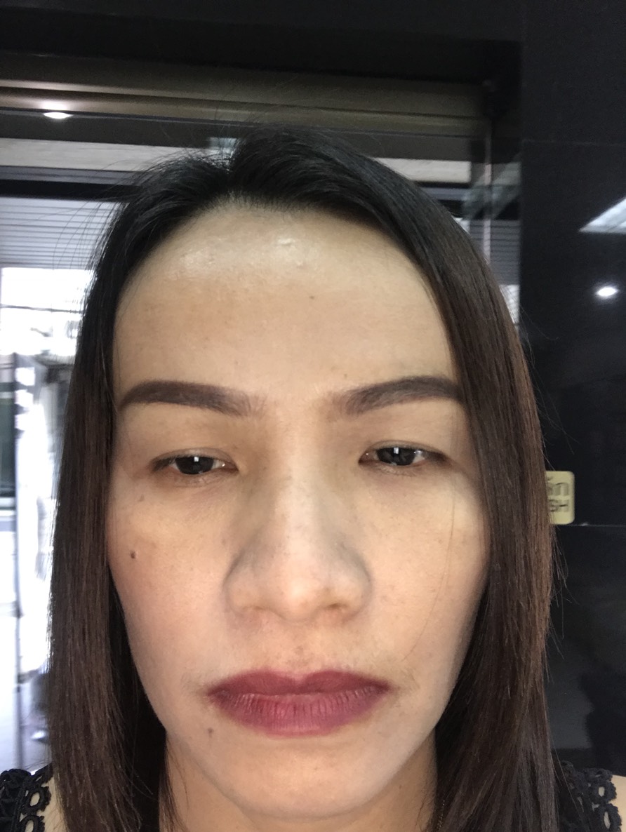 ตาสองชั้น